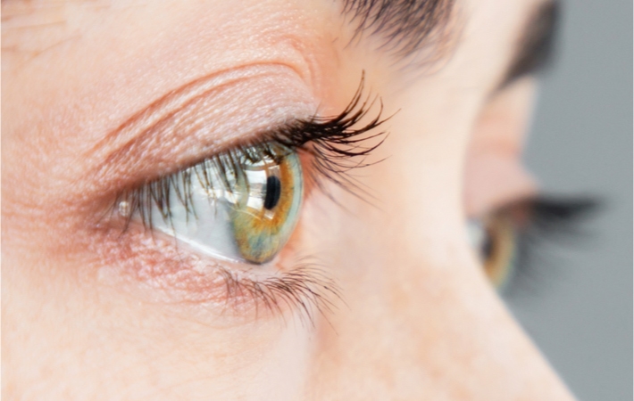 Close up myopia woman's right eye with green iris