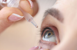 a person giving themselves eye drops to treat pink eye