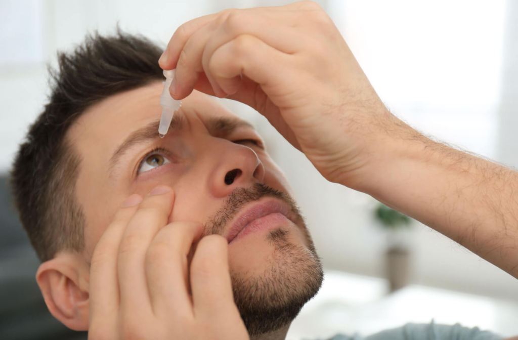 A young man pulling down his upper right cheek to put artificial tears on his right eye.
