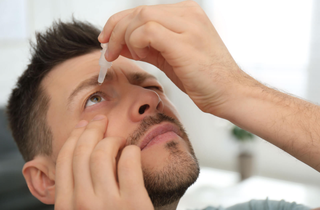 A young man pulling down his upper right cheek to put artificial tears on his right eye. dry eye