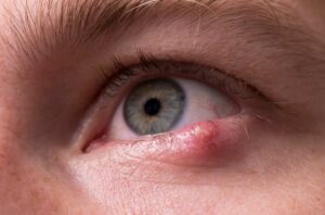 optometry-eyes-eyewear-eyeglasses-glasses-lenses-blue-light-filter-exposure-eye-fatigue-strain-dry-how-often-schedule-eye-exams-annual-comprehensive-cee-aee-optometrist-optical-illusions-eye-care-eyecare-vision-optometrist-eye-care-eyecare-risk-assessment-eye-doctor-optomap-retinal-imaging-onjunctivitis-viral-bacterial-fungal-allergic-pink-eye-optometrists-vs-ophthalmologists-vs-opticians-eye-doctor-near-me-optical-illusions-of-san-ramon-an-optometric-practice-city-center-bishop-ranch-parents-press-best-optometrists-chrome-hearts-eyewear-glasses-eyeglasses-sunglasses-frames-polarized-designer-luxury-fashion-perfect-pair-of-glasses-screen-time-childrens-eye-health-tired-eyes-asthenopia-stye-hordeloum