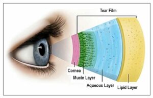 eye-allergies-allergy-season-itchy-swollen-eyes-red-swelling-optometry-dry-eyecare-care-health-exam-tears-crusty-eyes-eyecare