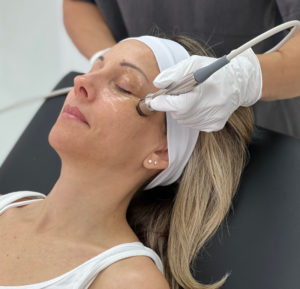 dry-eye-intense-pulse-light-lumecca-ipl-meibomian-gland-dysfunction-mgd-eye-health-eye-disease-spk-lipiflow-tearcare-ocular-surface-disease-optometry-eye-exam-optometrist-vsp-eyecare-eye-care-forma-radiofrequency-rf-morpheus-8-microneedling