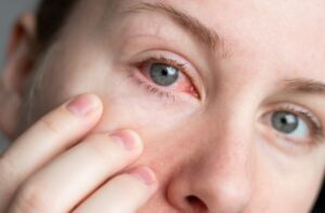 optometry-eyes-eyewear-eyeglasses-glasses-lenses-blue-light-filter-exposure-eye-fatigue-strain-dry-eye-exams-annual-comprehensive-cee-aee-optometrist-optical-illusions-eye-care-eyecare-vision-optometrist-eye-care-eyecare-opticians-eye-doctor-near-me-cartier-lindberg-chrome-hearts-eyewear-glasses-eyeglasses-sunglasses-frames-polarized-designer-luxury-contact-lenses-dry-eye