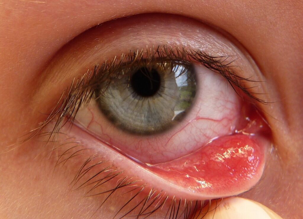 optometry-eyes-eyewear-eyeglasses-glasses-lenses-blue-light-filter-exposure-eye-fatigue-strain-dry-eye-exams-annual-comprehensive-cee-aee-optometrist-optical-illusions-eye-care-eyecare-vision-optometrist-eye-care-eyecare-opticians-eye-doctor-near-me-cartier-lindberg-chrome-hearts-eyewear-glasses-eyeglasses-sunglasses-frames-polarized-designer-luxury-dry-eyes