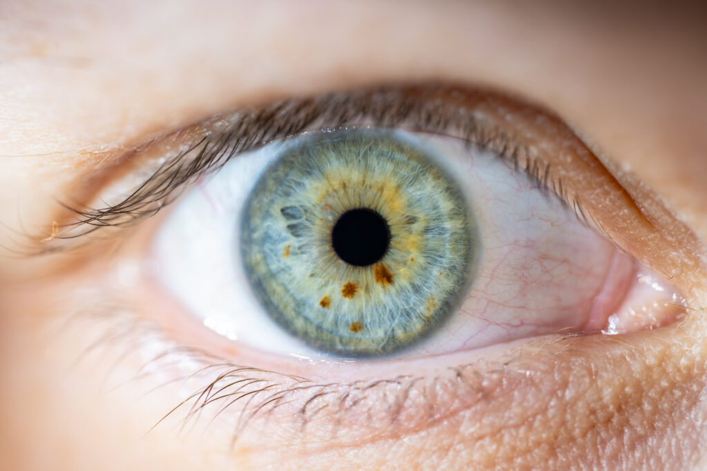 optometry-eyes-eyewear-eyeglasses-glasses-lenses-blue-light-filter-exposure-eye-fatigue-strain-dry-eye-exams-annual-comprehensive-cee-aee-optometrist-optical-illusions-eye-care-eyecare-vision-optometrist-eye-care-eyecare-opticians-eye-doctor-near-me-cartier-lindberg-chrome-hearts-eyewear-glasses-eyeglasses-sunglasses-frames-polarized-designer-luxury-eye freckles