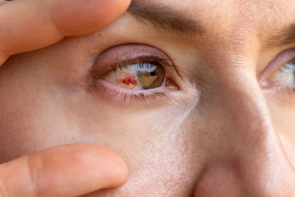optometry-eyes-eyewear-eyeglasses-glasses-lenses-blue-light-filter-exposure-eye-fatigue-strain-dry-eye-exams-annual-comprehensive-cee-aee-optometrist-optical-illusions-eye-care-eyecare-vision-optometrist-eye-care-eyecare-opticians-eye-doctor-near-me-cartier-lindberg-chrome-hearts-eyewear-sunglasses-frames-polarized-designer-luxury-red-eyes