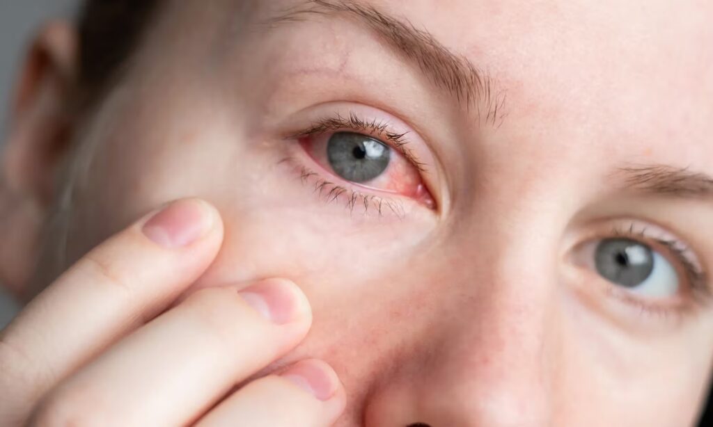 optometry-eyes-eyewear-eyeglasses-glasses-lenses-blue-light-filter-exposure-eye-fatigue-strain-dry-eye-exams-annual-comprehensive-cee-aee-optometrist-optical-illusions-eye-care-eyecare-vision-optometrist-eye-care-eyecare-opticians-eye-doctor-near-me-cartier-lindberg-chrome-hearts-eyewear-sunglasses-frames-polarized-designer-luxury-red-eyes