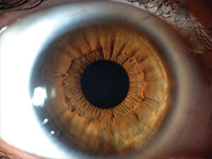 optometry-eyes-eyewear-eyeglasses-glasses-lenses-blue-light-filter-exposure-eye-fatigue-strain-dry-eye-exams-annual-comprehensive-cee-aee-optometrist-optical-illusions-eye-care-eyecare-vision-optometrist-eye-care-eyecare-opticians-eye-doctor-near-me-cartier-lindberg-chrome-hearts-eyewear-sunglasses-frames-polarized-designer-luxury