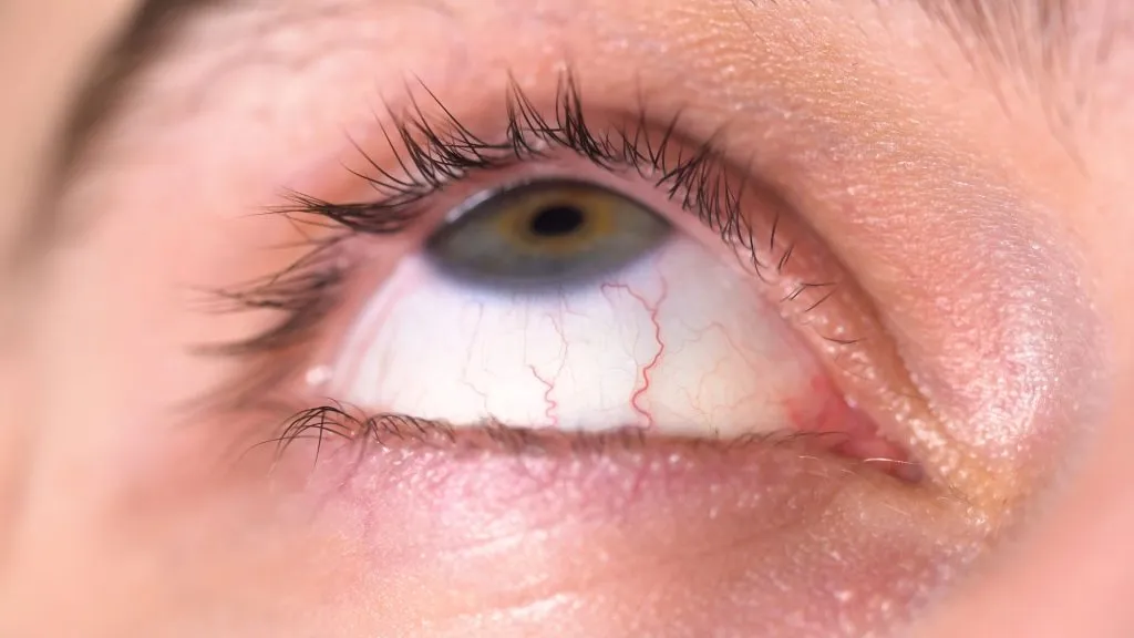 optometry-eyes-eyewear-eyeglasses-glasses-lenses-blue-light-filter-exposure-eye-fatigue-strain-dry-eye-exams-annual-comprehensive-cee-aee-optometrist-optical-illusions-eye-care-eyecare-vision-optometrist-eye-care-eyecare-opticians-eye-doctor-near-me-cartier-lindberg-chrome-hearts-eyewear-sunglasses-frames-polarized-designer-luxury