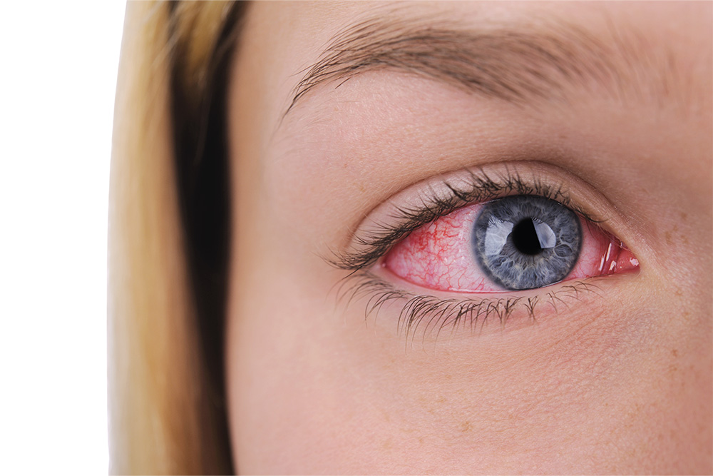 optometry-eyes-eyewear-eyeglasses-glasses-lenses-blue-light-filter-exposure-eye-fatigue-strain-dry-eye-exams-annual-comprehensive-cee-aee-optometrist-optical-illusions-eye-care-eyecare-vision-optometrist-eye-care-eyecare-opticians-eye-doctor-near-me-cartier-lindberg-chrome-hearts-eyewear-glasses-eyeglasses-sunglasses-frames-polarized-designer-luxury-nicotine