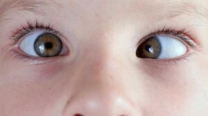 optometry-eyes-eyewear-eyeglasses-glasses-lenses-blue-light-filter-exposure-eye-fatigue-strain-dry-eye-exams-annual-comprehensive-cee-aee-optometrist-optical-illusions-eye-care-eyecare-vision-optometrist-eye-care-eyecare-opticians-eye-doctor-near-me-cartier-lindberg-chrome-hearts-eyewear-glasses-eyeglasses-sunglasses-frames-polarized-designer-luxury-strabismus-eye
