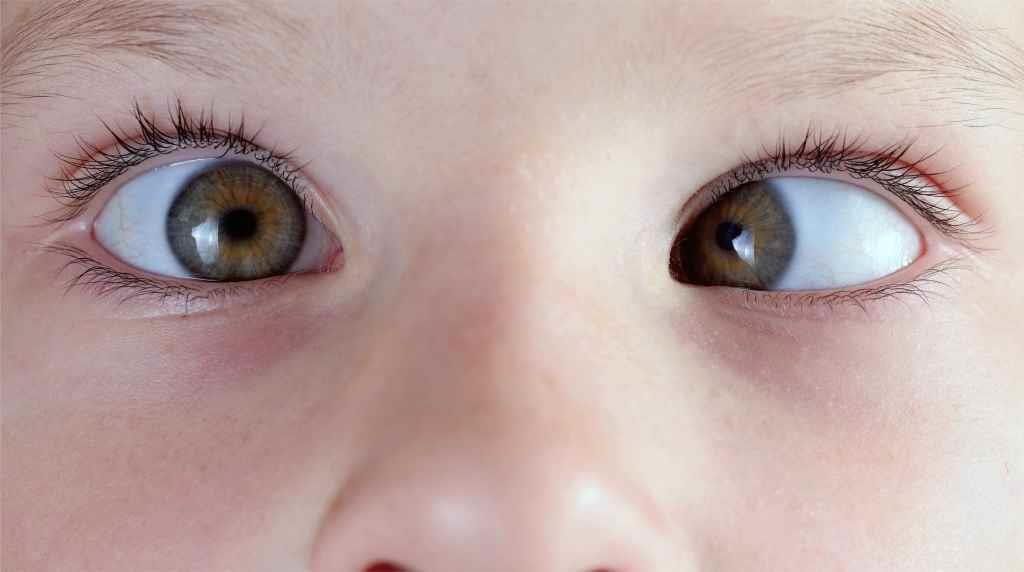 optometry-eyes-eyewear-eyeglasses-glasses-lenses-blue-light-filter-exposure-eye-fatigue-strain-dry-eye-exams-annual-comprehensive-cee-aee-optometrist-optical-illusions-eye-care-eyecare-vision-optometrist-eye-care-eyecare-opticians-eye-doctor-near-me-cartier-lindberg-chrome-hearts-eyewear-glasses-eyeglasses-sunglasses-frames-polarized-designer-luxury-strabismus-eye