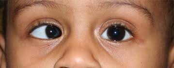 optometry-eyes-eyewear-eyeglasses-glasses-lenses-blue-light-filter-exposure-eye-fatigue-strain-dry-eye-exams-annual-comprehensive-cee-aee-optometrist-optical-illusions-eye-care-eyecare-vision-optometrist-eye-care-eyecare-opticians-eye-doctor-near-me-cartier-lindberg-chrome-hearts-eyewear-glasses-eyeglasses-sunglasses-frames-polarized-designer-luxury-strabismus