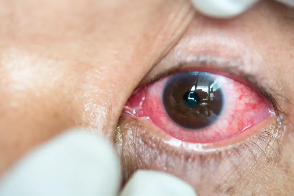 optometry-eyes-eyewear-eyeglasses-glasses-lenses-blue-light-filter-exposure-eye-fatigue-strain-dry-eye-exams-annual-comprehensive-cee-aee-optometrist-optical-illusions-eye-care-eyecare-vision-optometrist-eye-care-eyecare-opticians-eye-doctor-near-me-cartier-lindberg-chrome-hearts-eyewear-glasses-eyeglasses-sunglasses-frames-polarized-designer-luxury-contact lenses