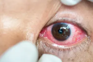 optometry-eyes-eyewear-eyeglasses-glasses-lenses-blue-light-filter-exposure-eye-fatigue-strain-dry-eye-exams-annual-comprehensive-cee-aee-optometrist-optical-illusions-eye-care-eyecare-vision-optometrist-eye-care-eyecare-opticians-eye-doctor-near-me-cartier-lindberg-chrome-hearts-eyewear-glasses-eyeglasses-sunglasses-frames-polarized-designer-luxury-contact lenses