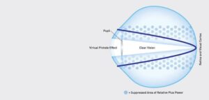 naturalvue-contact-lenses-contacts-optometry-eyes-eyewear-eyeglasses-glasses-lenses-blue-light-filter-exposure-eye-fatigue-strain-dry-eye-exams-annual-comprehensive-cee-aee-optometrist-optical-illusions-eye-care-eyecare-vision-optometrist-eye-care-eyecare-opticians-eye-doctor-near-me-cartier-lindberg-chrome-hearts-eyewear-sunglasses-frames-polarized-designer-luxury