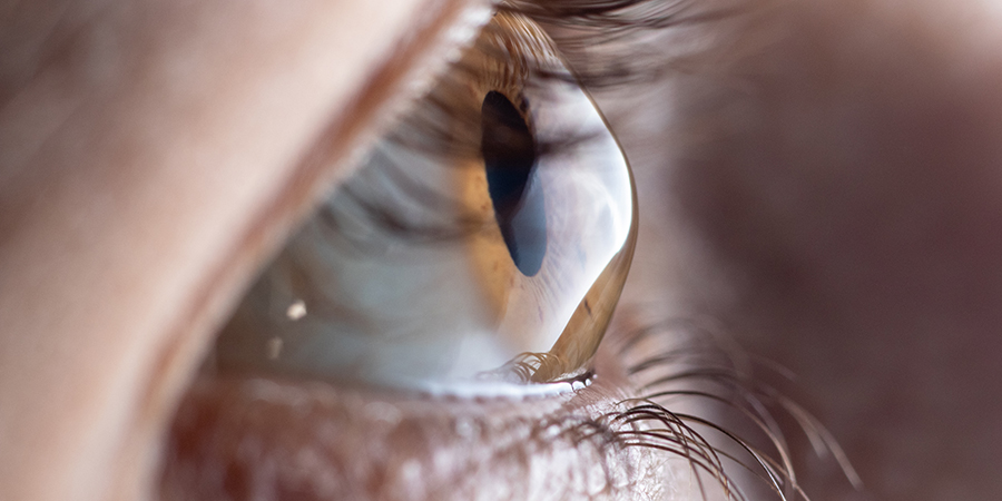 optometry-eyes-eyewear-eyeglasses-glasses-lenses-blue-light-filter-exposure-eye-fatigue-strain-dry-eye-exams-annual-comprehensive-cee-aee-optometrist-optical-illusions-eye-care-eyecare-vision-optometrist-eye-care-eyecare-opticians-eye-doctor-near-me-cartier-lindberg-chrome-hearts-eyewear-glasses-eyeglasses-sunglasses-frames-polarized-designer-luxury-night driving-keratoconus