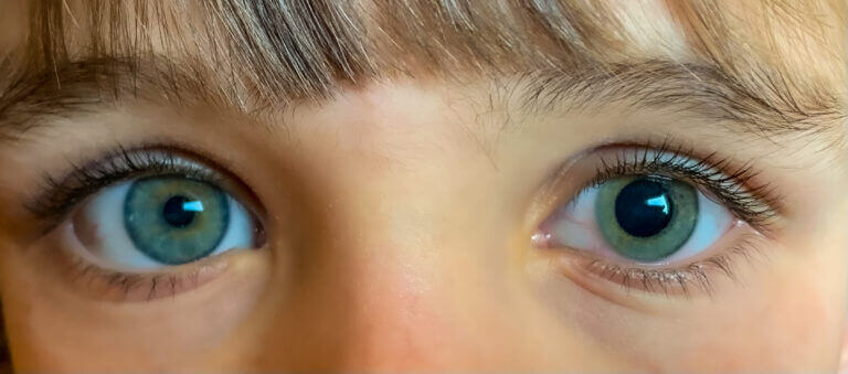 optometry-eyes-eyewear-eyeglasses-glasses-lenses-blue-light-filter-exposure-eye-fatigue-strain-dry-eye-exams-annual-comprehensive-cee-aee-optometrist-optical-illusions-eye-care-eyecare-vision-optometrist-eye-care-eyecare-opticians-eye-doctor-near-me-cartier-lindberg-chrome-hearts-eyewear-glasses-eyeglasses-sunglasses-frames-polarized-designer-luxury-night driving-optos