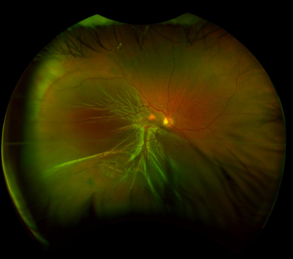 optometry-eyes-eyewear-eyeglasses-glasses-lenses-blue-light-filter-exposure-eye-fatigue-strain-dry-eye-exams-annual-comprehensive-cee-aee-optometrist-optical-illusions-eye-care-eyecare-vision-optometrist-eye-care-eyecare-opticians-eye-doctor-near-me-cartier-lindberg-chrome-hearts-eyewear-glasses-eyeglasses-sunglasses-frames-polarized-designer-luxury-night driving-optos
