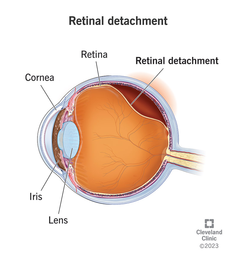 optometry-eyes-eyewear-eyeglasses-glasses-lenses-blue-light-filter-exposure-eye-fatigue-strain-dry-eye-exams-annual-comprehensive-cee-aee-optometrist-optical-illusions-eye-care-eyecare-vision-optometrist-eye-care-eyecare-opticians-eye-doctor-near-me-cartier-lindberg-chrome-hearts-eyewear-glasses-eyeglasses-sunglasses-frames-polarized-designer-luxury-night driving-retinal