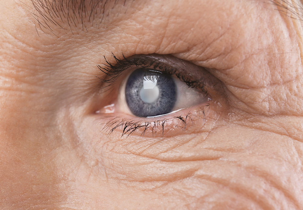 optometry-eyes-eyewear-eyeglasses-glasses-lenses-blue-light-filter-exposure-eye-fatigue-strain-dry-eye-exams-annual-comprehensive-cee-aee-optometrist-optical-illusions-eye-care-eyecare-vision-optometrist-eye-care-eyecare-opticians-eye-doctor-near-me-cartier-lindberg-chrome-hearts-eyewear-sunglasses-frames-polarized-designer-luxury-clean-eye
