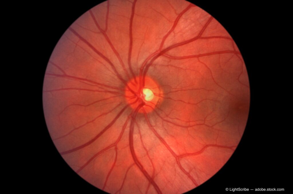 optometry-eyes-eyewear-eyeglasses-glasses-lenses-blue-light-filter-exposure-eye-fatigue-strain-dry-eye-exams-annual-comprehensive-cee-aee-optometrist-optical-illusions-eye-care-eyecare-vision-optometrist-eye-care-eyecare-opticians-eye-doctor-near-me-cartier-lindberg-chrome-hearts-eyewear-sunglasses-frames-polarized-designer-luxury-clean-eye
