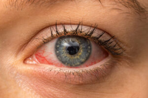 optometry-eyes-eyewear-eyeglasses-glasses-lenses-blue-light-filter-exposure-eye-fatigue-strain-dry-eye-exams-annual-comprehensive-cee-aee-optometrist-optical-illusions-eye-care-eyecare-vision-optometrist-eye-care-eyecare-opticians-eye-doctor-near-me-cartier-lindberg-chrome-hearts-eyewear-sunglasses-frames-polarized-designer-luxury-lasik-dryeye-dry-eye